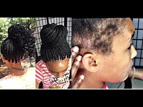 241. Tips To Protect Weak Edges + Itch Free Senegal Twist – Youtube Throughout Most Popular Cornrows Hairstyles For Weak Edges (Photo 2 of 15)