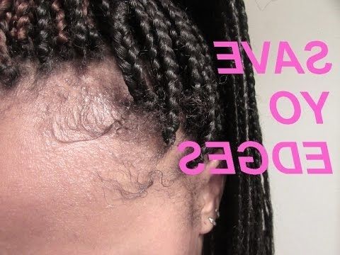 72) Braids: Save Yo Edges – Youtube Intended For Recent Braided Hairstyles Cover Bald Edges (View 14 of 15)
