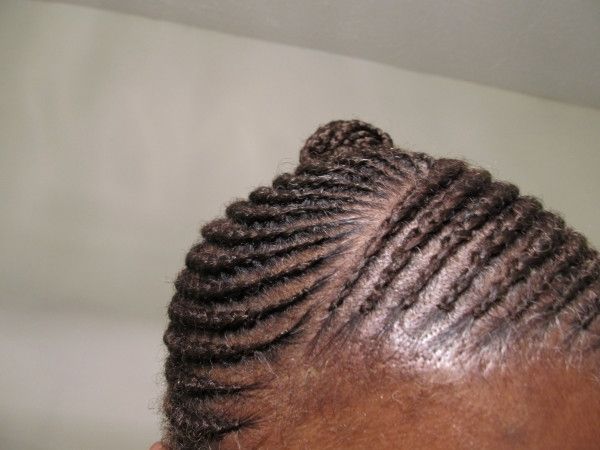 Bn Beauty: "help, I'm Losing My Hairline"! Find Out 7 Reasons Why Within Latest Cornrows Hairstyles For Receding Hairline (Photo 8 of 15)